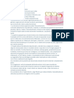 Definición de Pericoronaritis Modificando