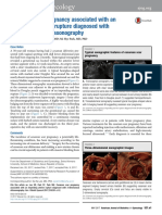 Cesarean Scar Pregnancy Associated With An Impending Uterine Rupture Diagnosed With 3-Dimensional Ultrasonography