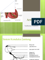 Arrhythmia Yudhist