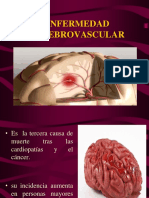 Tercera causa de muerte cerebrovascular