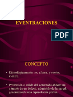 eventraciones