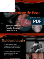 CANCER DE PENE.