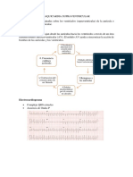 TAQUICARDIA SUPRAVENTRICULAR.docx