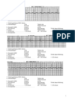 Latihan Interpretasi EKG A 10