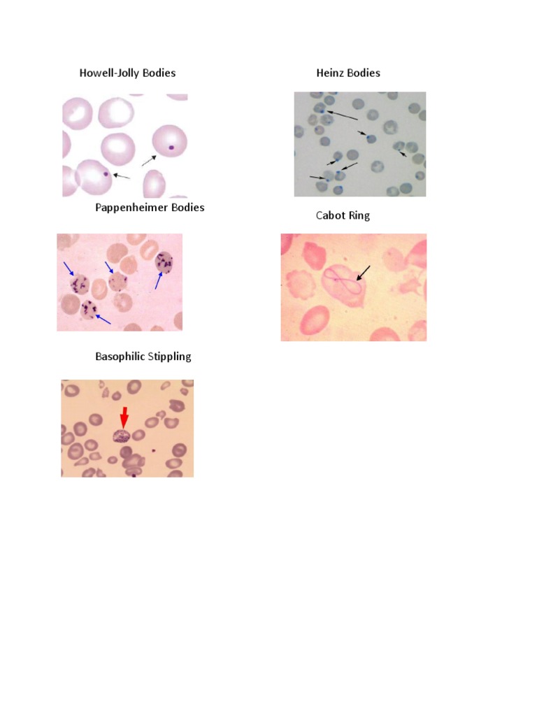 Inclusions | PDF | Hematology