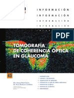OCT en Glaucoma