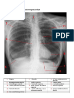 Radiografía de tórax: Anatomía y exámenes