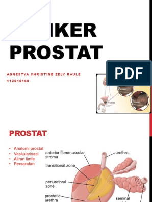 cred ca am prostatita)