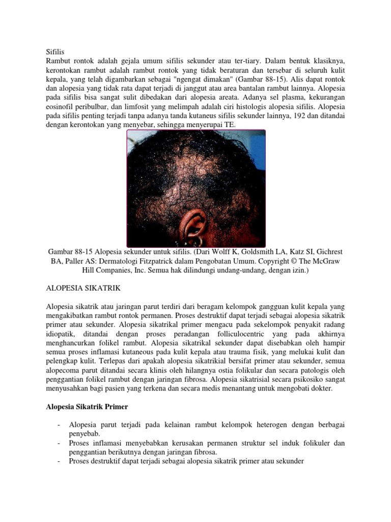 Hair Loss PDF