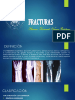 1 Fracturas