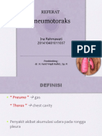 Pneumothorax Princess