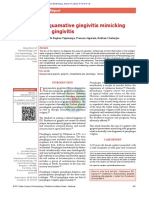 Desquamative Gingivitis Mimicking Mild Gingivitis: Case Report