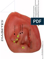 AURICULO PUNTOS Diabetes