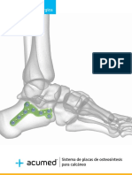 Acumed SurgicalTechnique Spanish Calcaneal Plating System ESLEX00 05 A