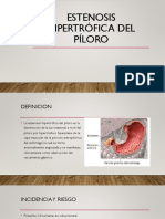 Estenosis Hipertrófica Del Píloro