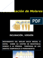 Vertical Molar