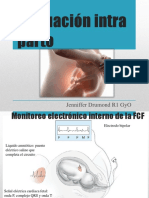 Evaluación intraparto de la FCF