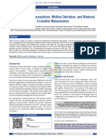 Open Bite, Root Resorptions, Midline Deviation, and Bilateral Crossbite Malocclusion