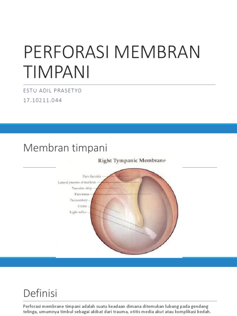 Perforasi Membran Timpani | PDF