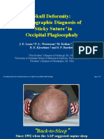 Skull Deformity: ! Radiographic Diagnosis of ! "Sticky Suture"in ! Occipital Plagiocephaly