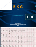 P Ekg