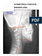 3º Articulo Análisis Biomecánico Cráneo Cervical (Rev. Chil. de Ortodoncia (1984) Completo - 2010