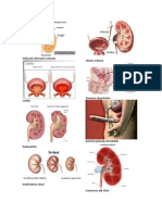 Infección Del Tracto Urinario