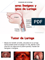 Tumores Benignos y Malignos de Laringe