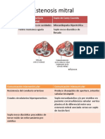 Estenosis Mitral