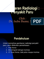 Gambaran Radiologi Penyakit Paru