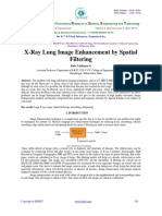 X-Ray Lung Image Enhancement by Spatial Filtering: I J I R S E T