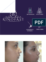 RINOPLASTIA