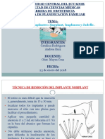 Implantes Completo