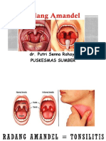 Tonsilitis