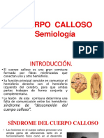 Cuerpo Calloso Semiologia