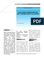 Hallazgos Radiologicos Tep 1