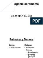 Bronchogenic Carcinoma: DR Ayman El-Dib