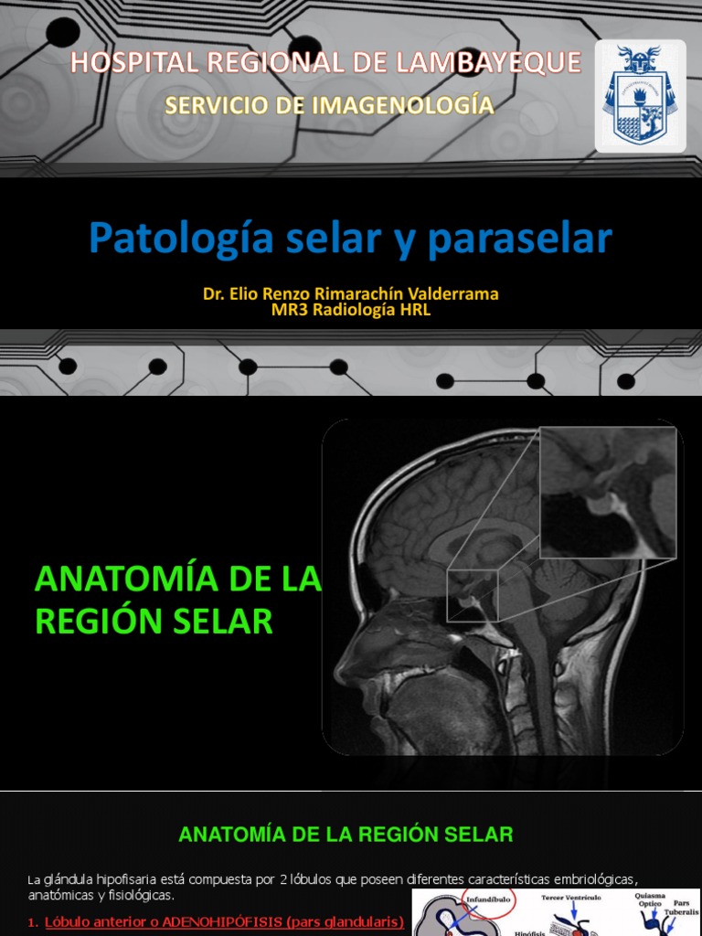 Anatomía de la Región Selar | PDF | Glándula pituitaria | Endocrinología