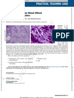 Practical Teaching Case: A Disease That Is Often Missed Without Gastrointestinal Symptoms