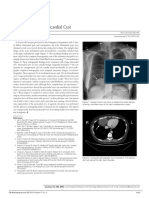 Image Diagnosis: Pericardial Cyst: Clinical Medicine