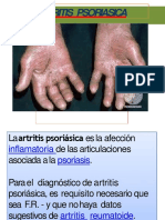 Artritis Psoriasica