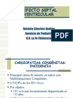 Defecto Septal Ventricular