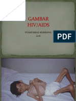 Gambar Hiv Aids