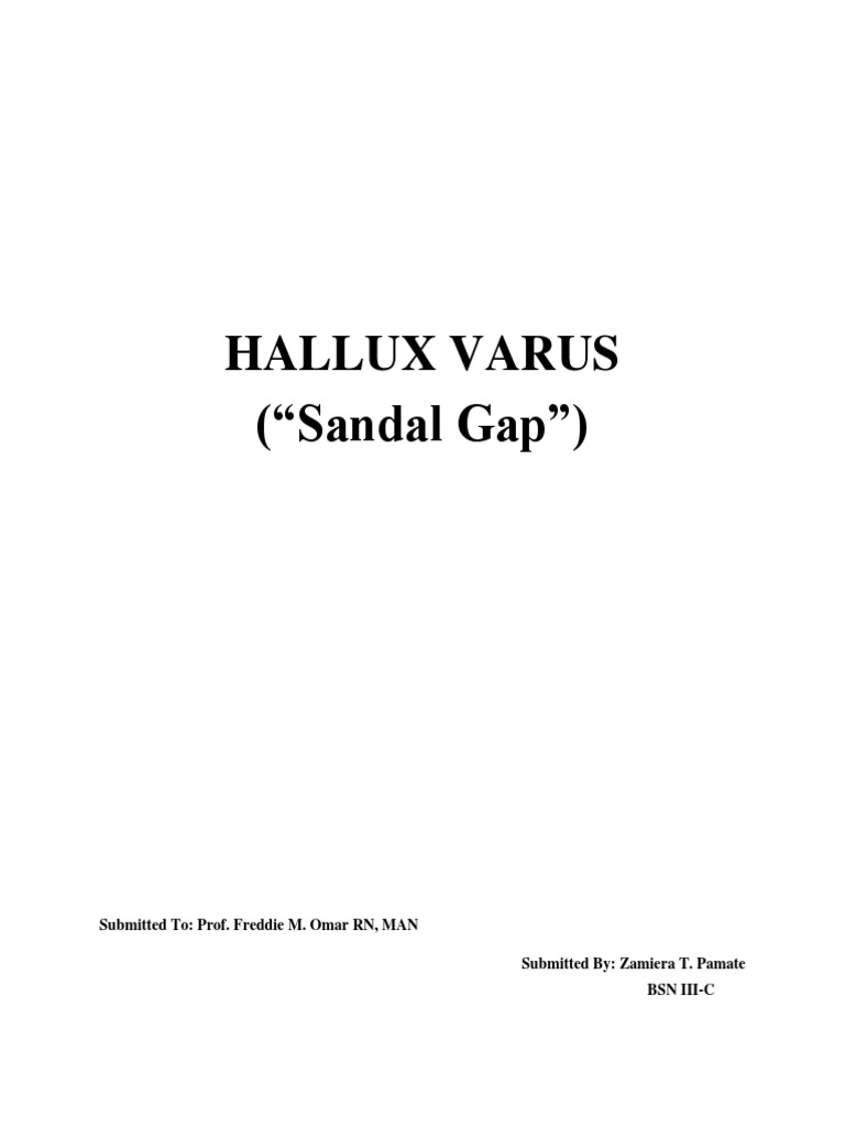 Hallux Varus: Causes and Treatment of the 