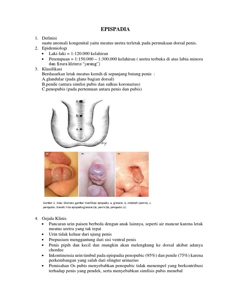 Rus pornosi kotarildi