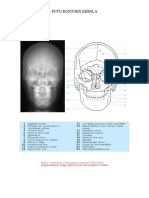 dokumen.tips_rontgen-kepala.doc