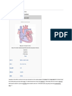 Regurgitasi Mitral