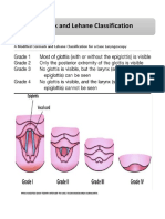 A Modified Cormack and Lehane Classification for a Ease Laryngoscopy