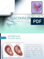 Placenta Previa