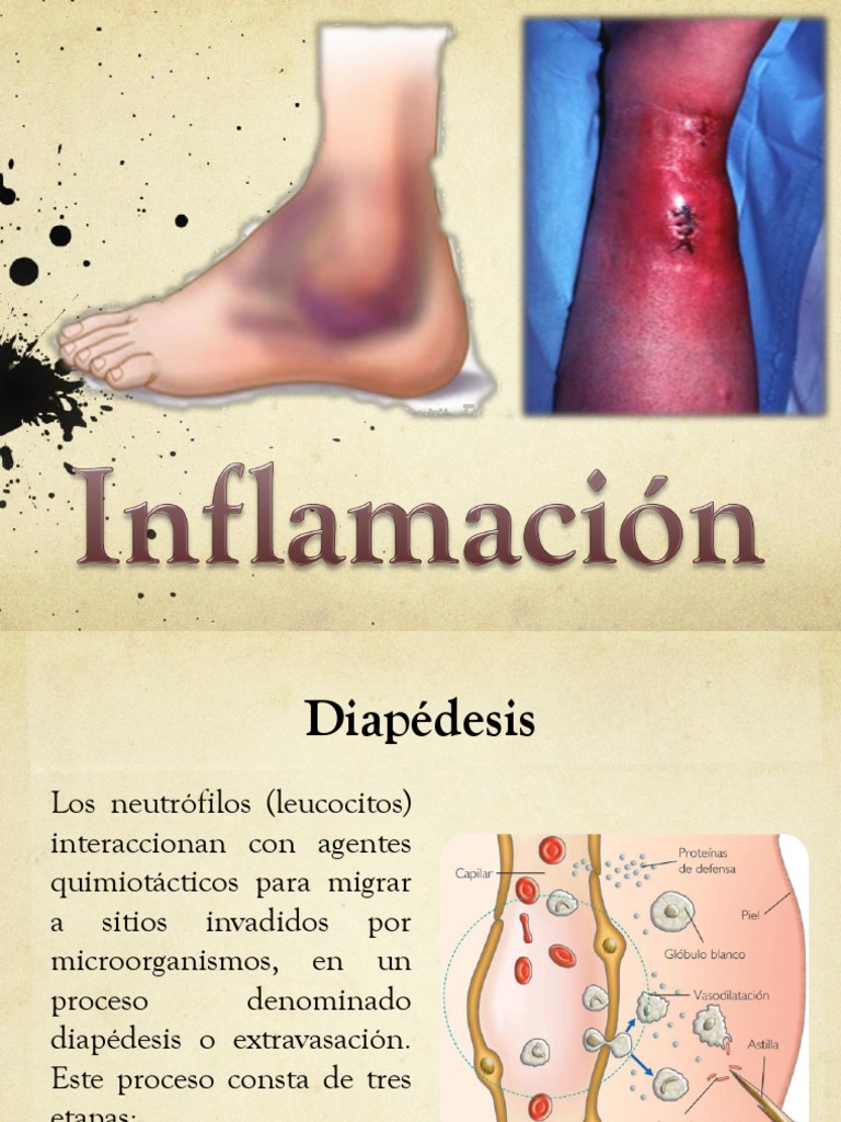 Diapédesis: Qué Es, Proceso, Hemorragia – EMQJN